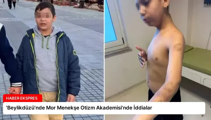 ‘Beylikdüzü’nde Mor Menekşe Otizm Akademisi’nde İddialar